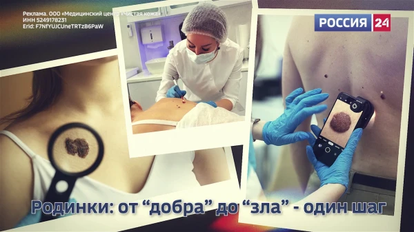 Меланома: Как распознать и победить? 